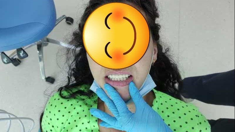 после протезирования зубов в Китае